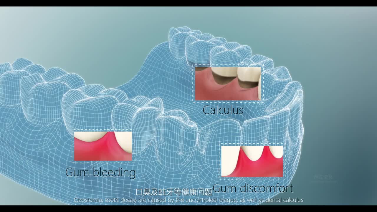 羅曼電動(dòng)牙刷廣告